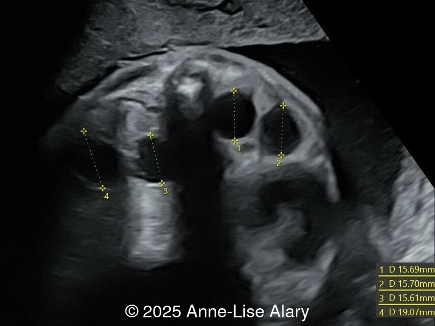 Axial image of the abdomen
