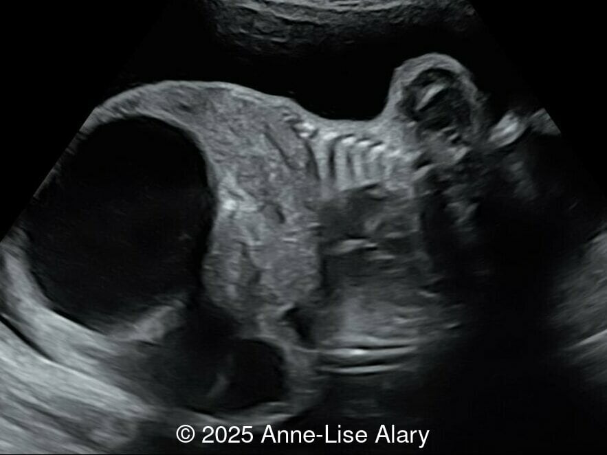 Coronal image of the thorax and abdomen