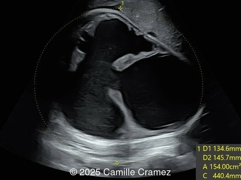 Axial image of the abdomen