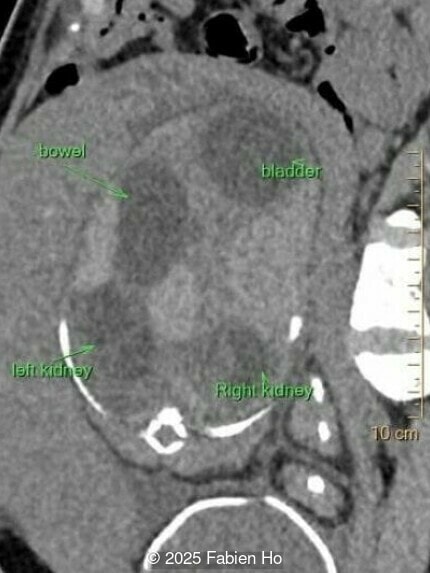 Axial image of the fetal abdomen