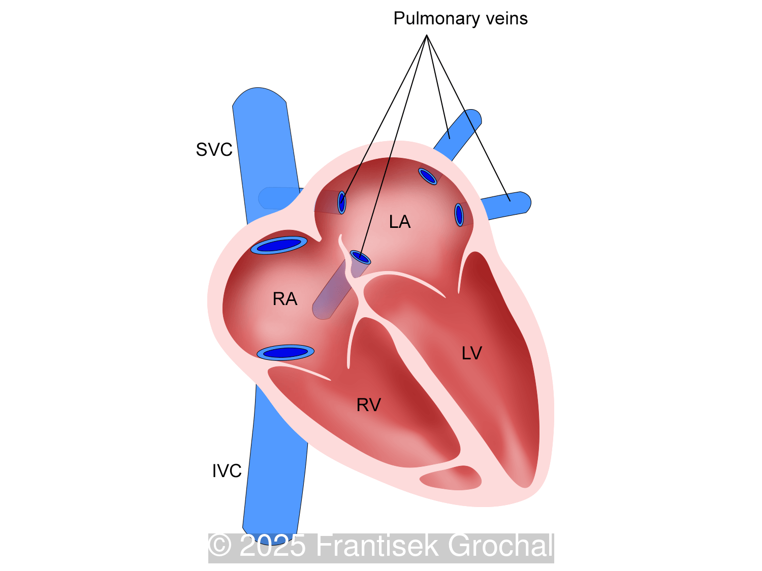 Normal anatomy of the pulmonary veins